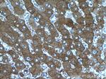 PKLR Antibody in Immunohistochemistry (Paraffin) (IHC (P))