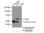PKLR Antibody in Immunoprecipitation (IP)