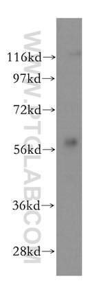 PKLR Antibody in Western Blot (WB)