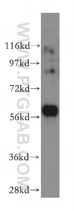 PKLR Antibody in Western Blot (WB)