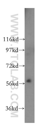 PKLR Antibody in Western Blot (WB)