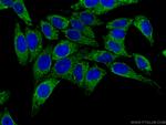 ATP5H Antibody in Immunocytochemistry (ICC/IF)