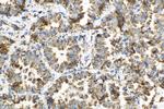 ATP5H Antibody in Immunohistochemistry (Paraffin) (IHC (P))