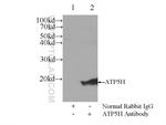 ATP5H Antibody in Immunoprecipitation (IP)