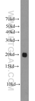 ATP5H Antibody in Western Blot (WB)