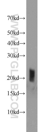 ATP5H Antibody in Western Blot (WB)