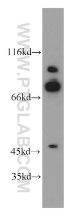 SMYD4 Antibody in Western Blot (WB)