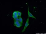CDAN1 Antibody in Immunocytochemistry (ICC/IF)