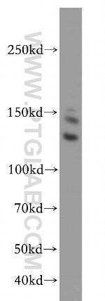 CDAN1 Antibody in Western Blot (WB)