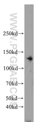 CDAN1 Antibody in Western Blot (WB)