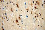 RSPH3 Antibody in Immunohistochemistry (Paraffin) (IHC (P))