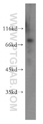 RSPH3 Antibody in Western Blot (WB)