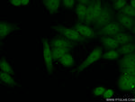 FIGNL1 Antibody in Immunocytochemistry (ICC/IF)