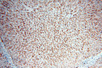 AKT2 Antibody in Immunohistochemistry (Paraffin) (IHC (P))