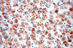 AKT2 Antibody in Immunohistochemistry (Paraffin) (IHC (P))