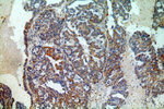 AKT2 Antibody in Immunohistochemistry (Paraffin) (IHC (P))
