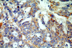 AKT2 Antibody in Immunohistochemistry (Paraffin) (IHC (P))