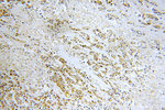 AKT2 Antibody in Immunohistochemistry (Paraffin) (IHC (P))