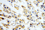 AKT2 Antibody in Immunohistochemistry (Paraffin) (IHC (P))