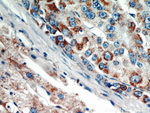 AKT2 Antibody in Immunohistochemistry (Paraffin) (IHC (P))