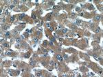 AKT2 Antibody in Immunohistochemistry (Paraffin) (IHC (P))