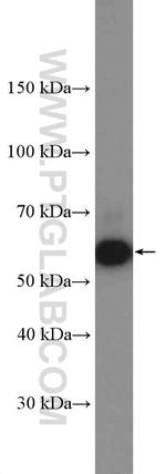 AKT2 Antibody in Western Blot (WB)