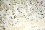 NDUFB2 Antibody in Immunohistochemistry (Paraffin) (IHC (P))