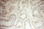 HEMGN Antibody in Immunohistochemistry (Paraffin) (IHC (P))