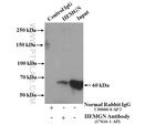 HEMGN Antibody in Immunoprecipitation (IP)