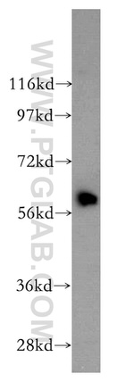HEMGN Antibody in Western Blot (WB)