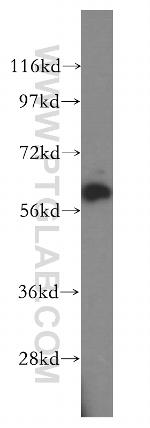 HEMGN Antibody in Western Blot (WB)