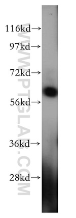 HEMGN Antibody in Western Blot (WB)
