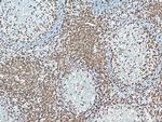 CD3 Antibody in Immunohistochemistry (Paraffin) (IHC (P))