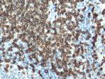 CD3 Antibody in Immunohistochemistry (Paraffin) (IHC (P))