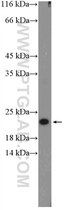 RPL26 Antibody in Western Blot (WB)