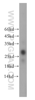 GSTT2B Antibody in Western Blot (WB)
