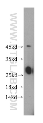 GSTT2B Antibody in Western Blot (WB)