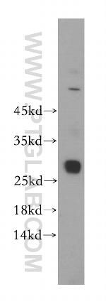 GSTT2B Antibody in Western Blot (WB)