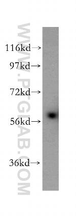 CD127/IL7R Antibody in Western Blot (WB)
