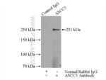 ASCC3 Antibody in Immunoprecipitation (IP)