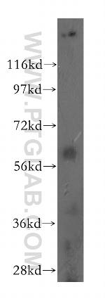 PRMT3 Antibody in Western Blot (WB)