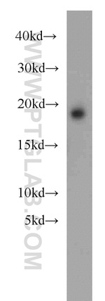 MSRB2 Antibody in Western Blot (WB)