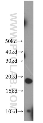 MSRB2 Antibody in Western Blot (WB)