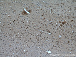 RORB Antibody in Immunohistochemistry (Paraffin) (IHC (P))
