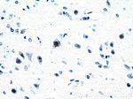 RORB Antibody in Immunohistochemistry (Paraffin) (IHC (P))