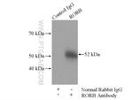 RORB Antibody in Immunoprecipitation (IP)