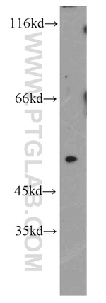 RORB Antibody in Western Blot (WB)