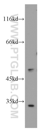 RORB Antibody in Western Blot (WB)
