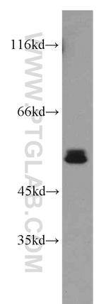 RORB Antibody in Western Blot (WB)