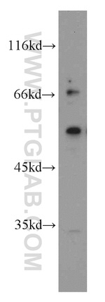 RORB Antibody in Western Blot (WB)